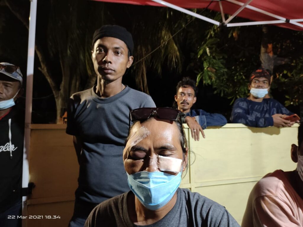 Foto Ajid yang mengalami luka diwajahnya