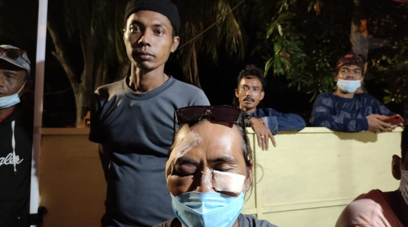 Foto Ajid yang mengalami luka diwajahnya