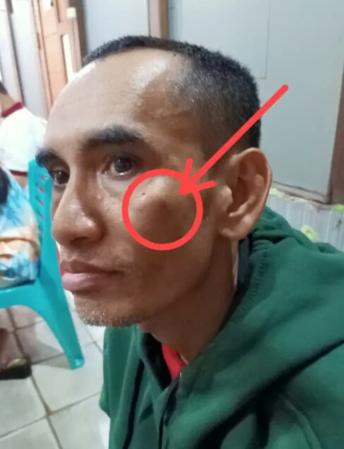 EN Korban Penganiyaan di Pontianak. (Ist)