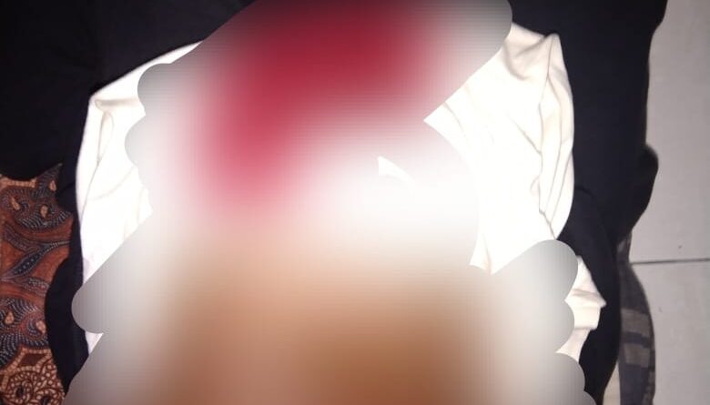 Korban Begal di Jakarta, Jum'at (6/8/2021) (Foto: IST)